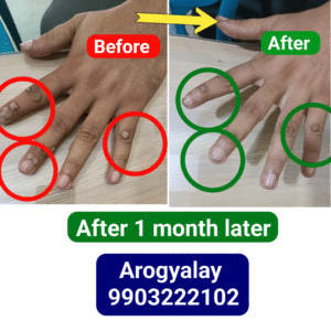 🌿 Best Skin Problem Treatment in Kolkata | Homeopathy Cure for Skin Diseases | Dr K Patra Specialist